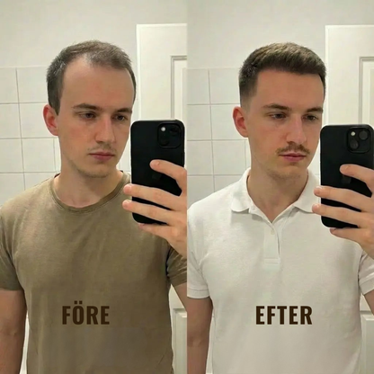 HårVital™ | Närande hårolja Som hjälper till att stimulera ny hårväxt och stärka hårsäckarna.