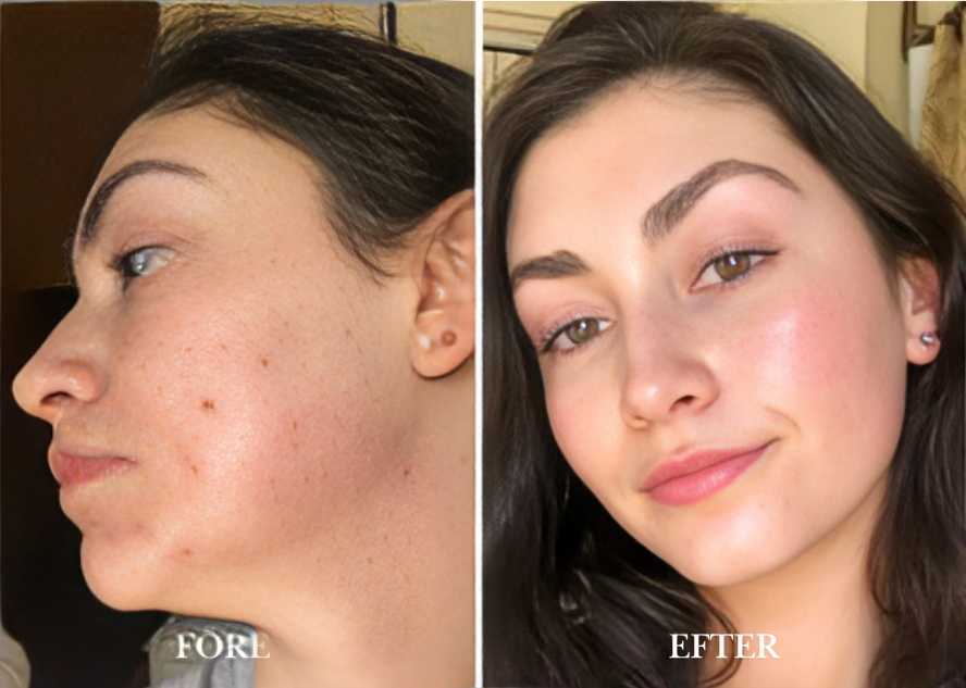 FinnRoll | Vävtejp för medicinskt bruk