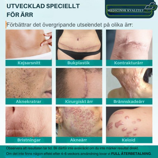 Avancerad ärrspray för alla typer av ärr ⚡️