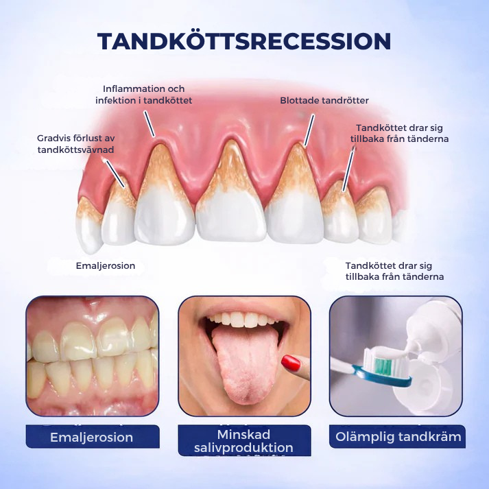 TandHälsa™ | Tand- och tandköttsstyrka