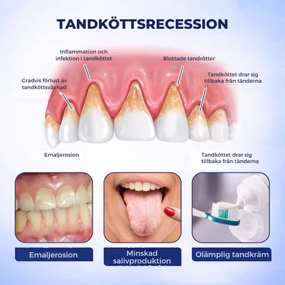TandHälsa™ | Tand- och tandköttsstyrka