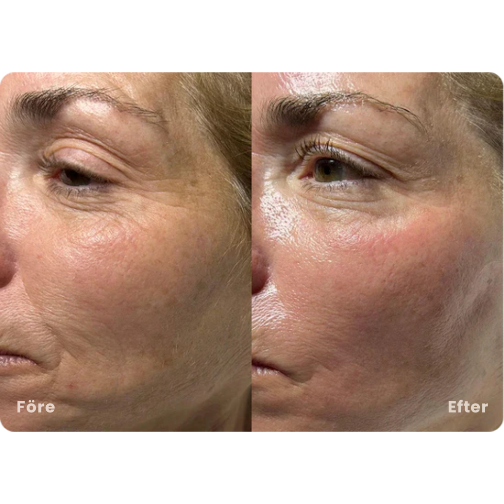 PeptidLift™ | Inomega avancerat PDRN Peptide-8-serum