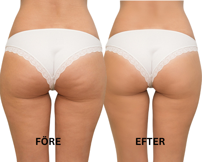 FORMÉA | Där skönhet tar form