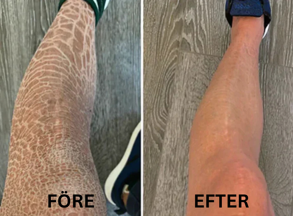 KlarHyll | Hudreparerande essence-kräm