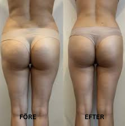 FORMÉA | Där skönhet tar form