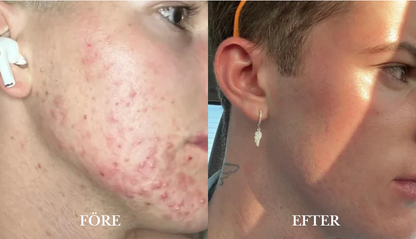 FinnRoll | Vävtejp för medicinskt bruk