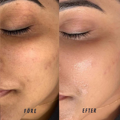 HudFörnyande Fuktserum