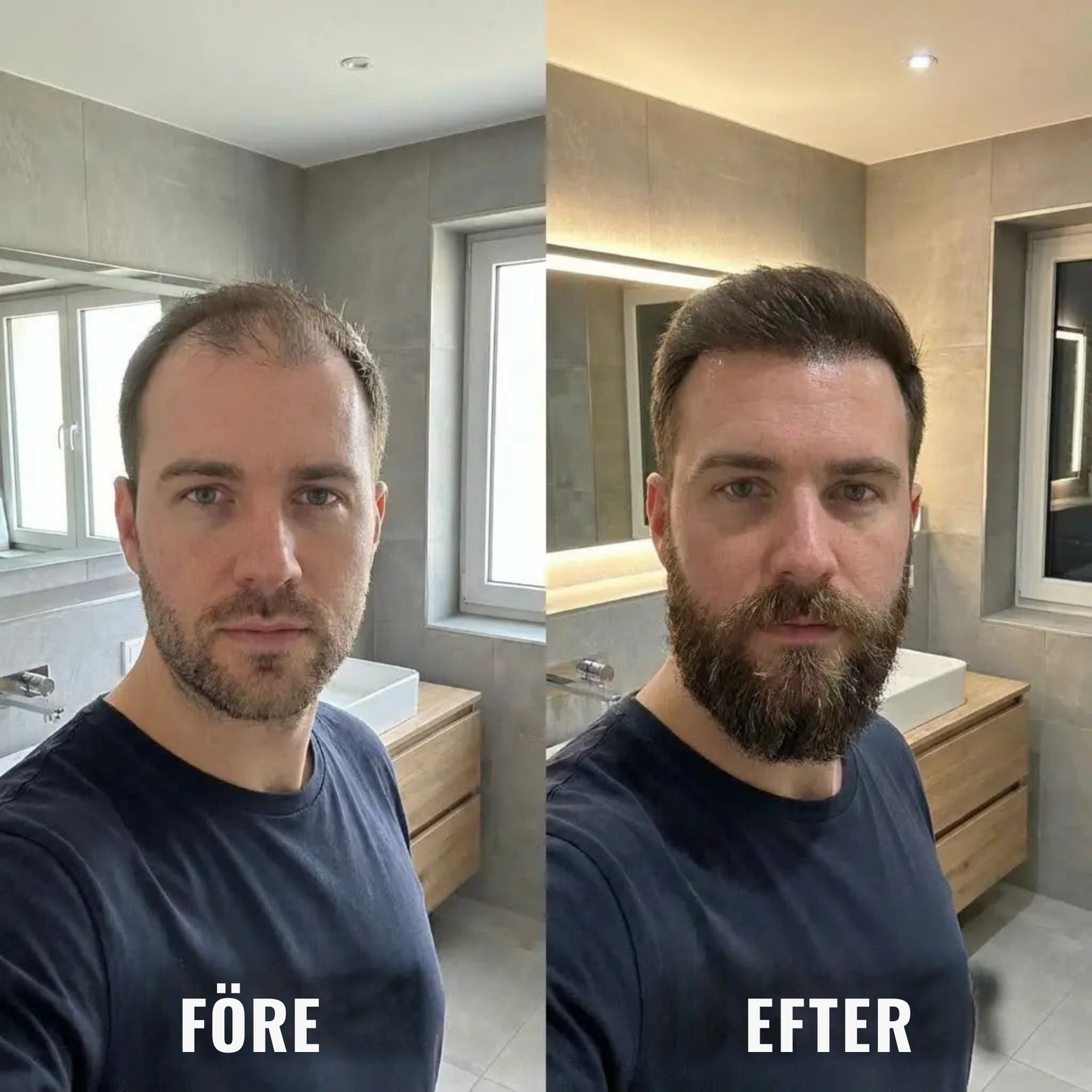 HårVital™ | Närande hårolja Som hjälper till att stimulera ny hårväxt och stärka hårsäckarna.