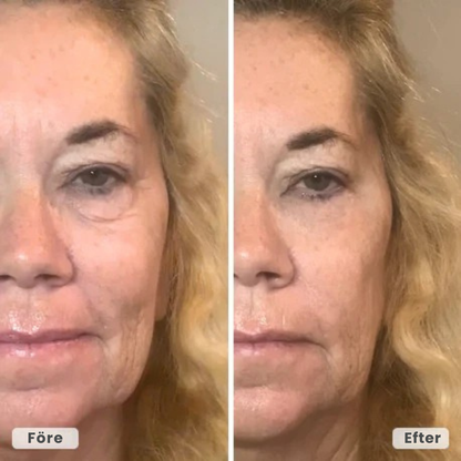 PeptidLift™ | Inomega avancerat PDRN Peptide-8-serum