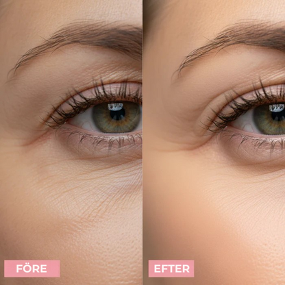 Elyna - PDRN Rosa Kollagen Exosom Shot Serum