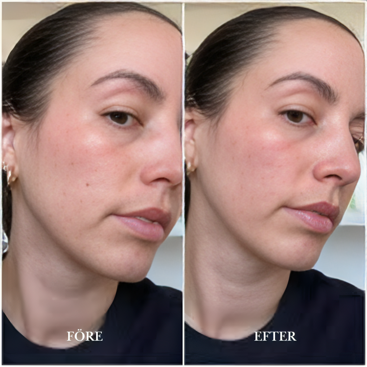 FinnRoll | Vävtejp för medicinskt bruk