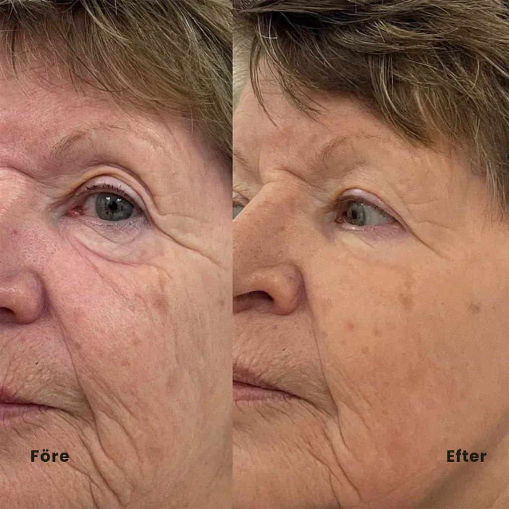 PeptidLift™ | Inomega avancerat PDRN Peptide-8-serum