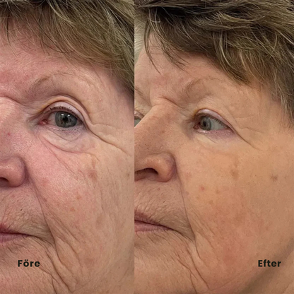 PeptidLift™ | Inomega avancerat PDRN Peptide-8-serum