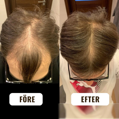 HårVital™ | Närande hårolja Som hjälper till att stimulera ny hårväxt och stärka hårsäckarna.