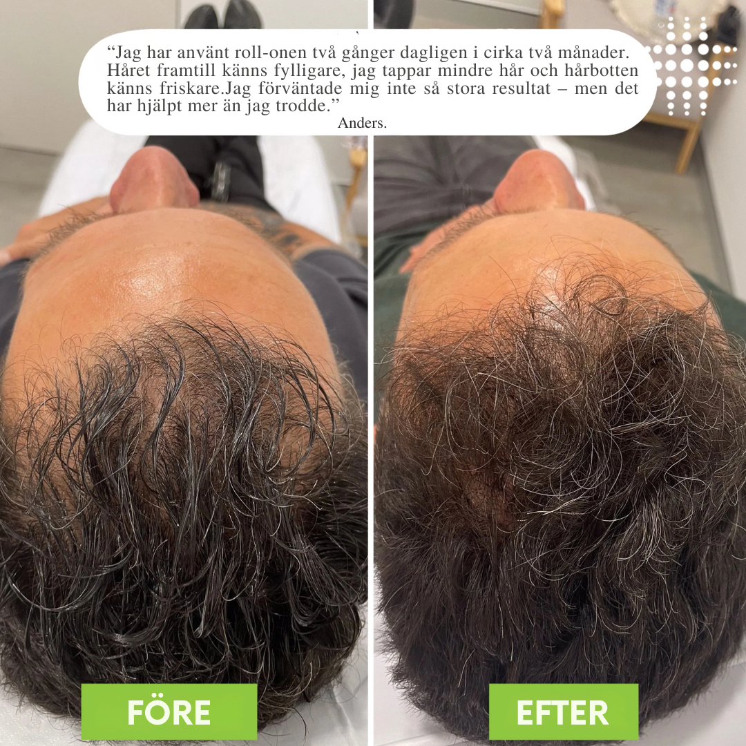 HårBalans™ | Hårväxtserum Roll-On