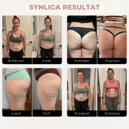 FormaLuxe™ | Leggings som aktivt motverkar celluliter
