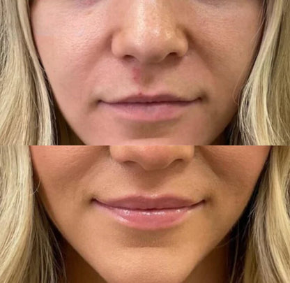 VolumeGlow – Läppförstoringande glansformel